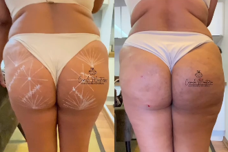 antes-depois2